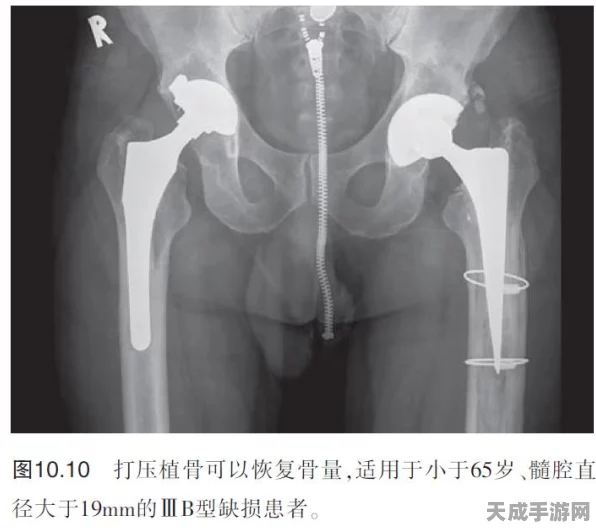 DNF深度揭秘，APC角色全解析，战斗策略与竞技精髓