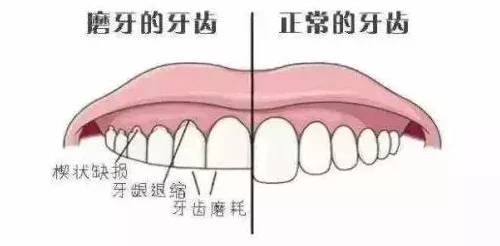 刀塔传奇巅峰对决揭秘，干扰者领衔的铜墙铁壁防守阵容攻略