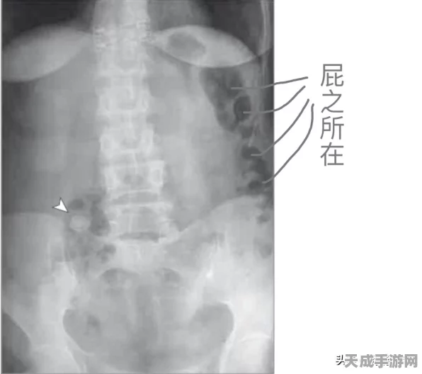 球球大作战，揭秘汉堡道具的奇妙作用与竞技策略